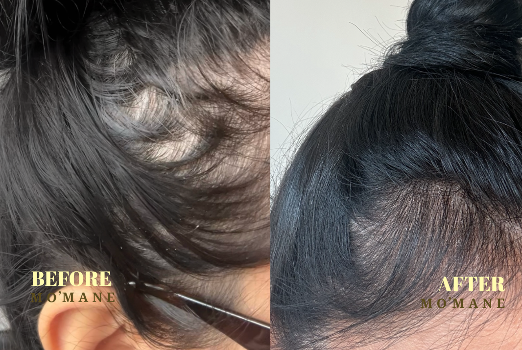 The Root Restoration Duo
